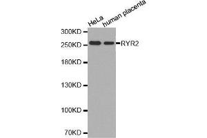 Image no. 1 for anti-Ryanodine Receptor 2 (Cardiac) (RYR2) antibody (ABIN1513493)