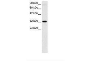 Image no. 3 for anti-Mesenchyme Homeobox 1 (MEOX1) (AA 38-87) antibody (ABIN6735804)