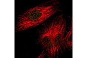 Image no. 1 for anti-Zinc Finger, DHHC-Type Containing 23 (ZDHHC23) antibody (ABIN5591198)