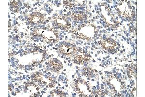 Image no. 1 for anti-Arginase, Liver (ARG1) (C-Term) antibody (ABIN2782310)