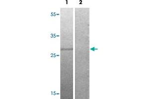Image no. 2 for anti-Oxidative-Stress Responsive 1 (OXSR1) (pThr185) antibody (ABIN5585122)
