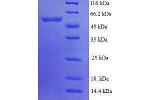 Image no. 1 for PYD (Pyrin Domain) Containing 1 (PYDC1) (AA 18-470) protein (His tag) (ABIN5710764)