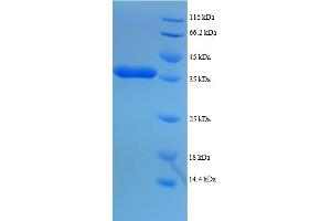 Image no. 1 for Dynein, Light Chain, LC8-Type 1 (DYNLL1) (AA 1-89), (full length) protein (GST tag) (ABIN5712129)