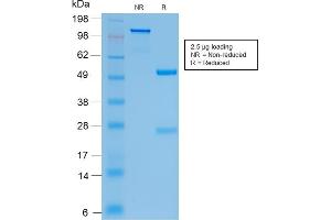 Image no. 1 for anti-Cystic Fibrosis Transmembrane Conductance Regulator (ATP-Binding Cassette Sub-Family C, Member 7) (CFTR) antibody (ABIN6939096)