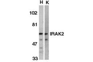 Image no. 1 for anti-Interleukin-1 Receptor-Associated Kinase 2 (IRAK2) (C-Term) antibody (ABIN6655354)