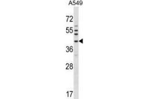 Image no. 1 for anti-NK6 Homeobox 1 (NKX6-1) (AA 284-314), (C-Term) antibody (ABIN953718)
