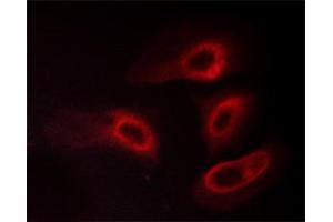 Image no. 3 for anti-14-3-3 zeta (YWHAZ) (pSer58) antibody (ABIN6256377)