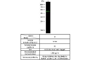 Image no. 3 for anti-Biotinidase (BTD) (AA 1-543) antibody (ABIN2691523)