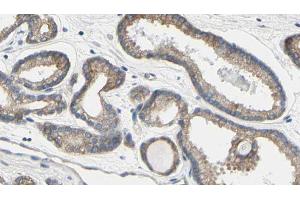Image no. 2 for anti-Trichoplein, Keratin Filament Binding (TCHP) (C-Term) antibody (ABIN6258431)