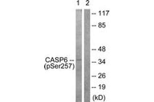 Western blot analysis of extracts from 293 cells treated with Etoposide 25uM 60', using Caspase 6 (Phospho-Ser257) Antibody.
