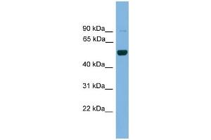 Image no. 1 for anti-Iroquois Homeobox Protein 2 (IRX2) (Middle Region) antibody (ABIN2779946)