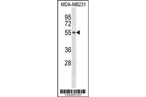 anti-Pepsinogen 3, Group I (Pepsinogen A) (PGA3) (AA 45-73), (N-Term) antibody