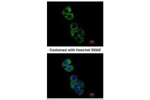 Image no. 2 for anti-Glutathione S-Transferase alpha 2 (GSTa2) (Center) antibody (ABIN2856132)