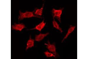 Image no. 2 for anti-Cadherin 19 (CDH19) (Internal Region) antibody (ABIN6257864)