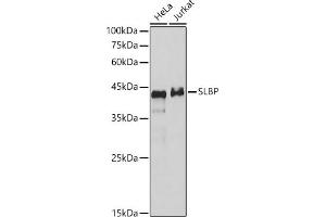 SLBP antibody
