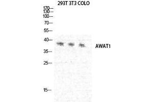 Image no. 3 for anti-Acyl-CoA Wax Alcohol Acyltransferase 1 (AWAT1) (C-Term) antibody (ABIN3184289)