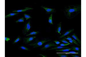 Image no. 3 for anti-Mitochondrial Ribosomal Protein S34 (MRPS34) (AA 1-218) antibody (ABIN949622)