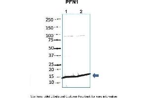 Image no. 4 for anti-Profilin 1 (PFN1) (N-Term) antibody (ABIN2783306)