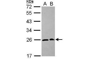 Image no. 2 for anti-SAR1 Homolog A (SAR1A) (Center) antibody (ABIN2855320)