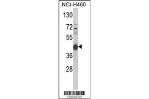 Image no. 1 for anti-Protein Kinase A, alpha (PRKACA) (AA 67-94), (N-Term) antibody (ABIN390798)