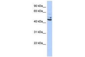 Image no. 1 for anti-Tumor Protein P53 Inducible Protein 13 (TP53I13) (C-Term) antibody (ABIN6741108)