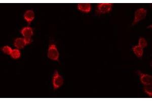 Image no. 2 for anti-Interleukin 7 Receptor (IL7R) (N-Term) antibody (ABIN6262569)