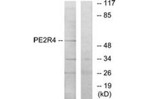 Image no. 2 for anti-Prostaglandin E Receptor 4 (Subtype EP4) (PTGER4) (AA 321-370) antibody (ABIN1535602)