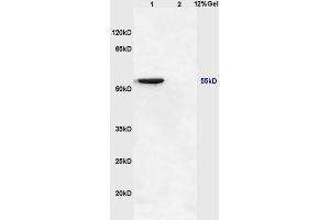 Image no. 3 for anti-Nuclear Factor of kappa Light Polypeptide Gene Enhancer in B-Cells Inhibitor, epsilon (NFKBIE) (AA 165-270) antibody (ABIN1386753)