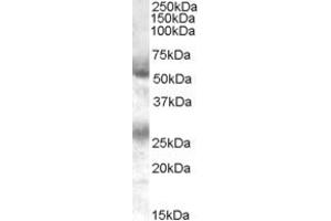 Image no. 1 for anti-Feline Leukemia Virus Subgroup C Cellular Receptor 1 (FLVCR1) (C-Term) antibody (ABIN185315)
