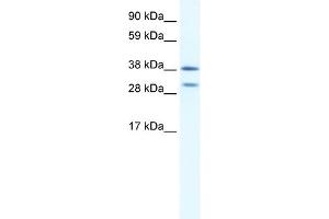NK2 Homeobox 3 antibody  (N-Term)