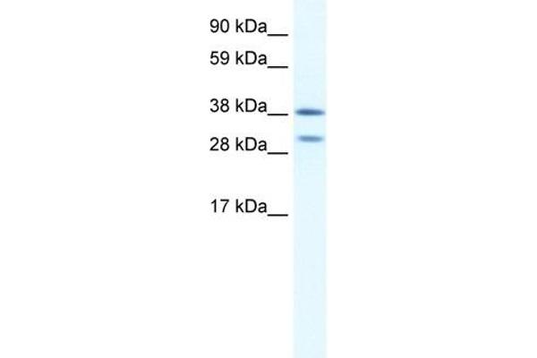 NK2 Homeobox 3 antibody  (N-Term)