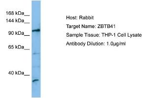 Host: Rabbit Target Name: ZBTB41 Sample Type: THP-1 Whole Cell lysates Antibody Dilution: 1.