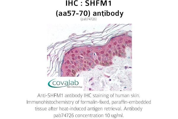 anti-Split Hand/foot Malformation (Ectrodactyly) Type 1 (SHFM1) (AA 57-70) antibody
