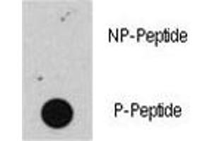 Image no. 2 for anti-Retinoblastoma Protein (Rb Protein) (pSer608) antibody (ABIN3028977)
