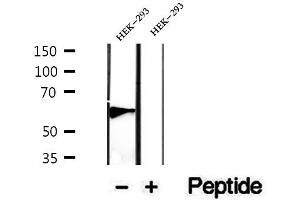 Image no. 1 for anti-PHD Finger Protein 17 (PHF17) antibody (ABIN6264173)
