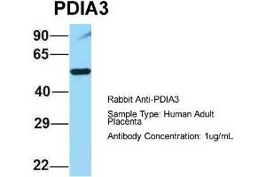 Image no. 4 for anti-Protein Disulfide Isomerase Family A, Member 3 (PDIA3) (C-Term) antibody (ABIN2774375)