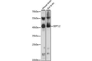 Image no. 1 for anti-Septin 12 (Sep12) antibody (ABIN6291643)
