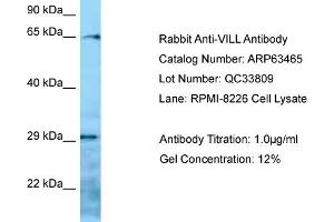 Image no. 1 for anti-Villin-Like (VILL) (N-Term) antibody (ABIN2789509)
