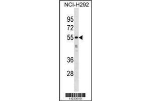 Image no. 1 for anti-Heterogeneous Nuclear Ribonucleoprotein H1 (H) (HNRNPH1) (AA 48-77), (N-Term) antibody (ABIN1881424)