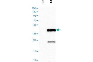 Image no. 2 for anti-Cathepsin S (CTSS) antibody (ABIN5576209)