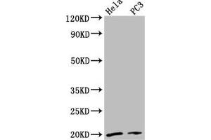 NDUFAF2 antibody  (AA 117-169)