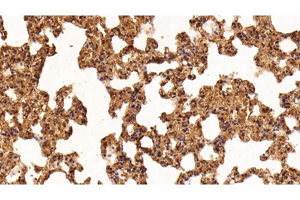 LGALS1/Galectin 1 antibody  (AA 1-135)
