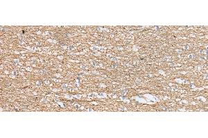 Immunohistochemistry of paraffin-embedded Human brain tissue using IDO2 Polyclonal Antibody at dilution of 1:45(x200)