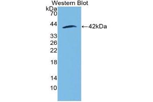 Image no. 1 for anti-Matrix Gla Protein (MGP) (AA 23-103) antibody (ABIN5013912)