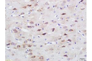 Image no. 3 for anti-Secreted Protein, Acidic, Cysteine-Rich (Osteonectin) (SPARC) (AA 101-200) antibody (ABIN738141)