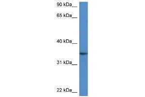 Image no. 1 for anti-Dehydrogenase/reductase (SDR Family) Member 3 (DHRS3) (Middle Region) antibody (ABIN2782653)