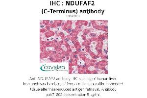 Image no. 2 for anti-NADH Dehydrogenase (Ubiquinone) 1 alpha Subcomplex, Assembly Factor 2 (NDUFAF2) (C-Term) antibody (ABIN1737237)
