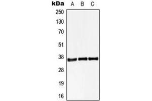 Image no. 1 for anti-StAR-Related Lipid Transfer (START) Domain Containing 10 (STARD10) (Center) antibody (ABIN2707109)