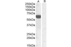 Image no. 2 for anti-Interferon Regulatory Factor 5 (IRF5) (C-Term) antibody (ABIN184812)