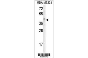 Image no. 1 for anti-Kelch Domain Containing 2 (KLHDC2) (AA 293-320), (C-Term) antibody (ABIN651014)